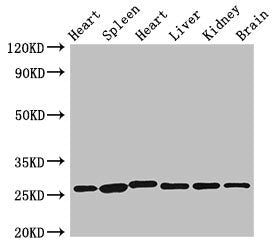 Western Blot
Positive WB detected in: Rat heart tissue, Rat spleen tissue, Mouse heart tissue, Mouse liver tissue, Mouse kidney tissue, Mouse brain tissue
All lanes: VEGFB antibody at 3.5µg/ml
Secondary
Goat polyclonal to rabbit IgG at 1/50000 dilution
Predicted band size: 22 kDa
Observed band size: 28 kDa