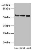 Western blot
All lanes: VIM antibody at 8µg/ml
Lane 1: Hela whole cell lysate
Lane 2: Jurkat whole cell lysate
Lane 3: A549 whole cell lysate
Secondary
Goat polyclonal to rabbit IgG at 1/10000 dilution
Predicted band size: 54 kDa
Observed band size: 54 kDa