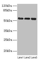 Western blot
All lanes: VIM antibody at 8µg/ml
Lane 1: Hela whole cell lysate
Lane 2: Jurkat whole cell lysate
Lane 3: A549 whole cell lysate
Secondary
Goat polyclonal to rabbit IgG at 1/10000 dilution
Predicted band size: 54 kDa
Observed band size: 54 kDa