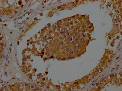 IHC image of CSB-PA025898LA01HU diluted at 1:200 and staining in paraffin-embedded human testis tissue performed on a Leica BondTM system. After dewaxing and hydration, antigen retrieval was mediated by high pressure in a citrate buffer (pH 6.0). Section was blocked with 10% normal goat serum 30min at RT. Then primary antibody (1% BSA) was incubated at 4°C overnight. The primary is detected by a Goat anti-rabbit polymer IgG labeled by HRP and visualized using 0.05% DAB.
