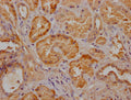 IHC image of CSB-PA025898LA11HU diluted at 1:300 and staining in paraffin-embedded human kidney tissue performed on a Leica BondTM system. After dewaxing and hydration, antigen retrieval was mediated by high pressure in a citrate buffer (pH 6.0). Section was blocked with 10% normal goat serum 30min at RT. Then primary antibody (1% BSA) was incubated at 4°C overnight. The primary is detected by a Goat anti-rabbit polymer IgG labeled by HRP and visualized using 0.05% DAB.