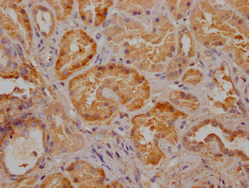 IHC image of CSB-PA025898LA11HU diluted at 1:300 and staining in paraffin-embedded human kidney tissue performed on a Leica BondTM system. After dewaxing and hydration, antigen retrieval was mediated by high pressure in a citrate buffer (pH 6.0). Section was blocked with 10% normal goat serum 30min at RT. Then primary antibody (1% BSA) was incubated at 4°C overnight. The primary is detected by a Goat anti-rabbit polymer IgG labeled by HRP and visualized using 0.05% DAB.
