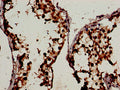 Immunohistochemistry analysis of human testis tissue using CSB-PA026113LA01HU at dilution of 1:100