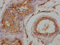 IHC image of CSB-PA026120LA01HU diluted at 1:200 and staining in paraffin-embedded human testis tissue performed on a Leica BondTM system. After dewaxing and hydration, antigen retrieval was mediated by high pressure in a citrate buffer (pH 6.0). Section was blocked with 10% normal goat serum 30min at RT. Then primary antibody (1% BSA) was incubated at 4°C overnight. The primary is detected by a Goat anti-rabbit IgG labeled by HRP and visualized using 0.05% DAB.