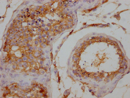IHC image of CSB-PA026120LA01HU diluted at 1:200 and staining in paraffin-embedded human testis tissue performed on a Leica BondTM system. After dewaxing and hydration, antigen retrieval was mediated by high pressure in a citrate buffer (pH 6.0). Section was blocked with 10% normal goat serum 30min at RT. Then primary antibody (1% BSA) was incubated at 4°C overnight. The primary is detected by a Goat anti-rabbit IgG labeled by HRP and visualized using 0.05% DAB.