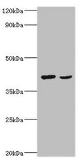 Western blot
All lanes: Protein Wnt-2 antibody at 2ug/ml
Lane 1: HepG2 whole cell lysate
Lane 2: MCF-7 whole cell lysate
Secondary
Goat polyclonal to rabbit IgG at 1/10000 dilution
Predicted band size: 40 kDa
Observed band size: 40 kDa
