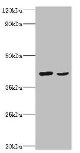Western blot
All lanes: Protein Wnt-2 antibody at 2ug/ml
Lane 1: HepG2 whole cell lysate
Lane 2: MCF-7 whole cell lysate
Secondary
Goat polyclonal to rabbit IgG at 1/10000 dilution
Predicted band size: 40 kDa
Observed band size: 40 kDa