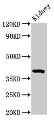 Western Blot
Positive WB detected in: Mouse kidney tissue
All lanes: Wnt3 antibody at 3.2µg/ml
Secondary
Goat polyclonal to rabbit IgG at 1/50000 dilution
Predicted band size: 40 kDa
Observed band size: 40 kDa