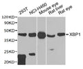 Western blot
All lanes: XBP1 antibody at 1:1000 dilution
Lane 1: 293T whole cell lysate
Lane 2: NCI-H460 whole cell lysate
Lane 3: Mouse eye tissue
Lane 4: Rat liver tissue
Lane 5: Rat eye tissue
Secondary
Goat polyclonal to rabbit IgG at 1/10000 dilution
Predicted band size: 29, 41 kDa
Observed band size: 41 kDa