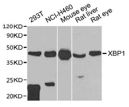 Western blot
All lanes: XBP1 antibody at 1:1000 dilution
Lane 1: 293T whole cell lysate
Lane 2: NCI-H460 whole cell lysate
Lane 3: Mouse eye tissue
Lane 4: Rat liver tissue
Lane 5: Rat eye tissue
Secondary
Goat polyclonal to rabbit IgG at 1/10000 dilution
Predicted band size: 29, 41 kDa
Observed band size: 41 kDa