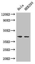 Western Blot
Positive WB detected in: Hela whole cell lysate, HEK293 whole cell lysate
All lanes: ACTG1 antibody at 3ug/ml
Secondary
Goat polyclonal to rabbit IgG at 1/50000 dilution
Predicted band size: 42 kDa
Observed band size: 42 kDa