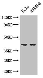Western Blot
Positive WB detected in: Hela whole cell lysate, HEK293 whole cell lysate
All lanes: ACTG1 antibody at 3ug/ml
Secondary
Goat polyclonal to rabbit IgG at 1/50000 dilution
Predicted band size: 42 kDa
Observed band size: 42 kDa
