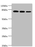 Western blot
All lanes: X-ray repair cross-complementing protein 5 antibody at 2ug/ml
Lane 1: A549 whole cell lysate
Lane 2: MCF-7 whole cell lysate
Lane 3: 293T whole cell lysate
Secondary
Goat polyclonal to rabbit IgG at 1/10000 dilution
Predicted band size: 83 kDa
Observed band size: 83 kDa