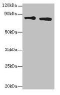 Western blot
All lanes: XRCC5 antibody at 6µg/ml
Lane 1: HepG2 whole cell lysate
Lane 2: Hela whole cell lysate
Secondary
Goat polyclonal to rabbit IgG at 1/10000 dilution
Predicted band size: 83 kDa
Observed band size: 83 kDa