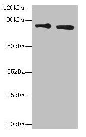 Western blot
All lanes: XRCC5 antibody at 6µg/ml
Lane 1: HepG2 whole cell lysate
Lane 2: Hela whole cell lysate
Secondary
Goat polyclonal to rabbit IgG at 1/10000 dilution
Predicted band size: 83 kDa
Observed band size: 83 kDa