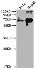 Western Blot
Positive WB detected in: Hela whole cell lysate, HepG2 whole cell lysate
All lanes: YAP1 antibody at 1:2000
Secondary
Goat polyclonal to rabbit IgG at 1/50000 dilution
Predicted band size: 55, 53, 49, 37, 49, 50, 51, 54 kDa
Observed band size: 65 kDa