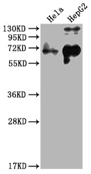 Western Blot
Positive WB detected in: Hela whole cell lysate, HepG2 whole cell lysate
All lanes: YAP1 antibody at 1:2000
Secondary
Goat polyclonal to rabbit IgG at 1/50000 dilution
Predicted band size: 55, 53, 49, 37, 49, 50, 51, 54 kDa
Observed band size: 65 kDa