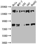 Western Blot
Positive WB detected in: Hela whole cell lysate, MCF-7 whole cell lysate, L02 whole cell lysate, U87 whole cell lysate, HepG2 whole cell lysate
All lanes: ZFYVE9 antibody at 1:1000
Secondary
Goat polyclonal to rabbit IgG at 1/50000 dilution
Predicted band size: 157, 151, 84 kDa
Observed band size: 157 kDa