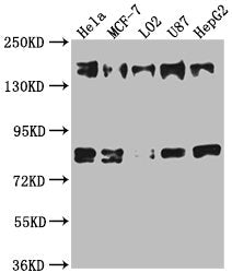 Western Blot
Positive WB detected in: Hela whole cell lysate, MCF-7 whole cell lysate, L02 whole cell lysate, U87 whole cell lysate, HepG2 whole cell lysate
All lanes: ZFYVE9 antibody at 1:1000
Secondary
Goat polyclonal to rabbit IgG at 1/50000 dilution
Predicted band size: 157, 151, 84 kDa
Observed band size: 157 kDa