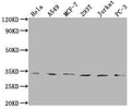 Western Blot
Positive WB detected in: Hela whole cell lysate, A549 whole cell lysate, MCF-7 whole cell lysate, 293T whole cell lysate, Jurkat whole cell lysate, PC-3 whole cell lysate
All lanes: ZNF346 antibody at 1:1000
Secondary
Goat polyclonal to rabbit IgG at 1/50000 dilution
Predicted band size: 33, 36, 30 kDa
Observed band size: 33 kDa