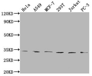Western Blot
Positive WB detected in: Hela whole cell lysate, A549 whole cell lysate, MCF-7 whole cell lysate, 293T whole cell lysate, Jurkat whole cell lysate, PC-3 whole cell lysate
All lanes: ZNF346 antibody at 1:1000
Secondary
Goat polyclonal to rabbit IgG at 1/50000 dilution
Predicted band size: 33, 36, 30 kDa
Observed band size: 33 kDa