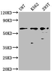 Western Blot
Positive WB detected in: U87 whole cell lysate, K562 whole cell lysate, 293T whole cell lysate
All lanes: ZNF37A antibody at 2.6µg/ml
Secondary
Goat polyclonal to rabbit IgG at 1/50000 dilution
Predicted band size: 66 kDa
Observed band size: 66 kDa