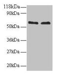 Western blot
All lanes: FUS antibody at 2µg/ml
Lane 1: 293T whole cell lysate
Lane 2: EC109 whole cell lysate
Secondary
Goat polyclonal to rabbit IgG at 1/15000 dilution
Predicted band size: 54 kDa
Observed band size: 60 kDa