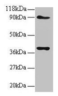Western blot
All lanes: NDUFS5 antibody at 2µg/ml
Lane 1: EC109 whole cell lysate
Lane 2: 293T whole cell lysate
Secondary
Goat polyclonal to rabbit IgG at 1/15000 dilution
Predicted band size: 13 kDa
Observed band size: 40 kDa