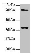 Western blot
All lanes: NDUFS5 antibody at 2µg/ml
Lane 1: EC109 whole cell lysate
Lane 2: 293T whole cell lysate
Secondary
Goat polyclonal to rabbit IgG at 1/15000 dilution
Predicted band size: 13 kDa
Observed band size: 40 kDa