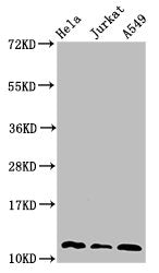 Western Blot
Positive WB detected in: Hela whole cell lysate, Jurkat whole cell lysate, A549 whole cell lysate
All lanes: TXN antibody at 3µg/ml
Secondary
Goat polyclonal to rabbit IgG at 1/50000 dilution
Predicted band size: 12, 10 kDa
Observed band size: 12 kDa