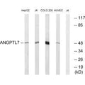 Western blot analysis of extracts from HepG2 cells, Jurkat cells, COLO cells and HUVEC cells, using ANGPTL7 antibody.