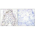 Immunohistochemistry analysis of paraffin-embedded human testis tissue, using HOXA1/B1/D1 antibody.
