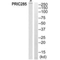 Western blot analysis of extracts from Jurkat cells, using PRIC285 antibody.