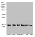 Western blot
All lanes: SOD1 antibody at 6µg/ml
Lane 1: Mouse liver tissue
Lane 2: Mouse brain tissue
Lane 3: Hela whole cell lysate
Lane 4: MCF-7 whole cell lysate
Lane 5: A549 whole cell lysate
Lane 6: HepG2 whole cell lysate
Secondary
Goat polyclonal to rabbit IgG at 1/10000 dilution
Predicted band size: 16 kDa
Observed band size: 16 kDa