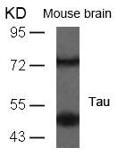 Western blot analysis of extracts from mouse brain tissue using Tau(Ab-235) Antibody.