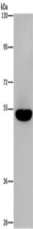 Gel: 6%SDS-PAGE, Lysate: 40 ug, Lane: Mouse brain tissue, Primary antibody: CSB-PA028950(AHRR Antibody) at dilution 1/860, Secondary antibody: Goat anti rabbit IgG at 1/8000 dilution, Exposure time: 2 minutes