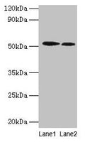 Western blot
All lanes: RPS6KB2 antibody at 2µg/ml
Lane 1: EC109 whole cell lysate
Lane 2: 293T whole cell lysate
Secondary
Goat polyclonal to rabbit IgG at 1/15000 dilution
Predicted band size: 54, 17 kDa
Observed band size: 54 kDa