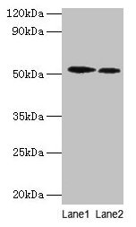 Western blot
All lanes: RPS6KB2 antibody at 2µg/ml
Lane 1: EC109 whole cell lysate
Lane 2: 293T whole cell lysate
Secondary
Goat polyclonal to rabbit IgG at 1/15000 dilution
Predicted band size: 54, 17 kDa
Observed band size: 54 kDa