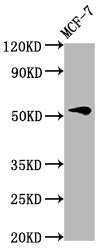 Western Blot
Positive WB detected in: MCF-7 whole cell lysate
All lanes: VTN antibody at 4.6µg/ml
Secondary
Goat polyclonal to rabbit IgG at 1/50000 dilution
Predicted band size: 55 kDa
Observed band size: 55 kDa