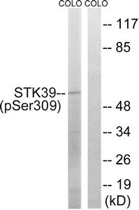 Western blot analysis of extracts from COLO cells using STK39 (Phospho-Ser309) Antibody.The lane on the right is treated with the antigen-specific peptide.