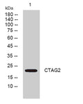 Western blot analysis of lysates from DU145 cells, primary antibody was diluted at 1:1000, 4°over night