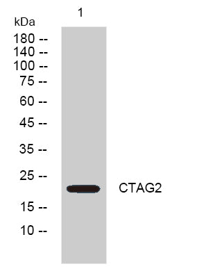 Western blot analysis of lysates from DU145 cells, primary antibody was diluted at 1:1000, 4°over night