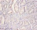 Immunohistochemistry of paraffin-embedded human kidney tissue using CSB-PA02989A0Rb at dilution of 1:100