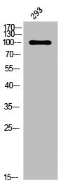 Phospho-PGR (S294) Antibody – Figure 1 of 1
