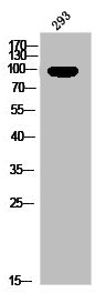 Western Blot analysis of 293 cells using Phospho-PR (S400) Polyclonal Antibody