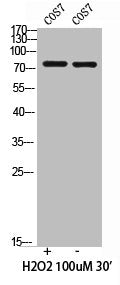 Phospho-PIK3R1/PIK3R3 (Y467/199) Antibody – Figure 1 of 1
