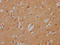 IHC image of CSB-PA030070HA01HU diluted at 1:200 and staining in paraffin-embedded human brain tissue performed on a Leica BondTM system. After dewaxing and hydration, antigen retrieval was mediated by high pressure in a citrate buffer (pH 6.0). Section was blocked with 10% normal goat serum 30min at RT. Then primary antibody (1% BSA) was incubated at 4°C overnight. The primary is detected by a Goat anti-rabbit polymer IgG labeled by HRP and visualized using 0.05% DAB.