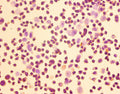 Immunohistochemistry of paraffin-embedded LO2 cells using CSB-PA03007A0Rb at dilution of 1:50