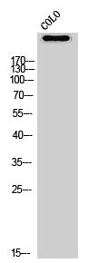 Western Blot analysis of COLO cells using ATR Polyclonal Antibody