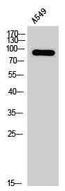 Western Blot analysis of A549 cells using cGKII Polyclonal Antibody